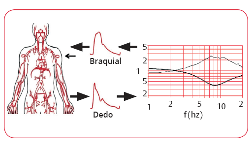 Reconstrucci&oacute;n de la presi&oacute;n arterial humeral